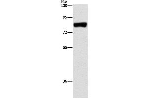 Western Blot analysis of Hela cell using ARHGAP25 Polyclonal Antibody at dilution of 1:500 (ARHGAP25 Antikörper)