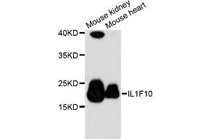 Western blot analysis of extracts of various cell lines, using IL1F10 antibody (ABIN6293249) at 1:3000 dilution.
