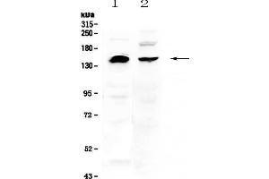 Western blot analysis of NEDD4 using anti-NEDD4 antibody .