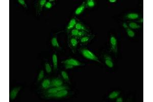 Immunofluorescence staining of Hela cells with ABIN7150342 at 1:166, counter-stained with DAPI. (Topoisomerase I Antikörper  (AA 358-501))