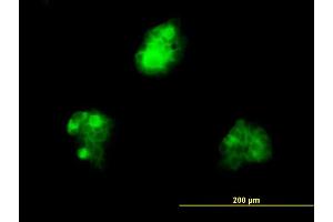 Immunofluorescence of monoclonal antibody to KHDRBS1 on A-431 cell. (KHDRBS1 Antikörper  (AA 176-275))