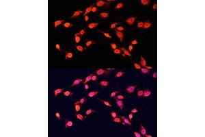 Immunofluorescence analysis of C6 cells using TriMethyl-Histone H3-K14 pAb (ABIN7267697) at dilution of 1:100 (40x lens).