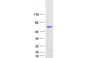 Western Blotting (WB) image for erythrocyte Membrane Protein Band 4.9 (Dematin) (EPB49) (Transcript Variant 1) protein (Myc-DYKDDDDK Tag) (ABIN2719378)