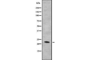 Western blot analysis IL28B using HuvEc whole cell lysates (IL28B Antikörper)