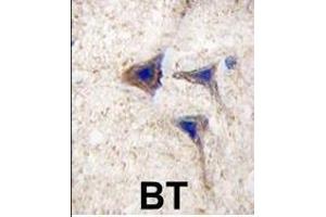 Formalin-fixed and paraffin-embedded human brain tissue reacted with BRAF Antibody , which was peroxidase-conjugated to the secondary antibody, followed by DAB staining. (SNRPE Antikörper  (AA 424-453))