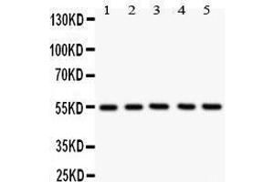 Anti-Glucose Transporter GLUT4 antibody, Western blotting All lanes: Anti Glucose Transporter GLUT4  at 0.