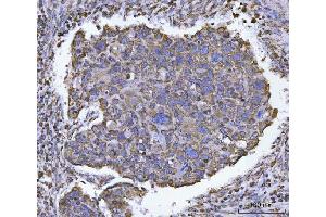 IHC analysis of ATP5F1B using anti-ATP5F1B antibody (ABIN7599866). (Atp5f1b (AA 123-529) Antikörper)