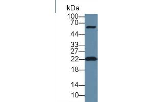 Western Blot; Sample: Human Hela cell lysate; Primary Ab: 1µg/ml Rabbit Anti-Human DTYMK Antibody Second Ab: 0. (DTYMK Antikörper  (AA 43-190))