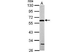 Western Blotting (WB) image for anti-Dihydrolipoamide Dehydrogenase (DLD) antibody (ABIN2854985)