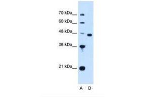 Image no. 1 for anti-Proliferation-Associated 2G4, 38kDa (PA2G4) (AA 178-227) antibody (ABIN321304) (PA2G4 Antikörper  (AA 178-227))