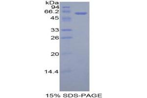 SDS-PAGE (SDS) image for Adiponectin Receptor 1 (ADIPOR1) (AA 1-136) protein (His tag,MBP tag) (ABIN1878039)