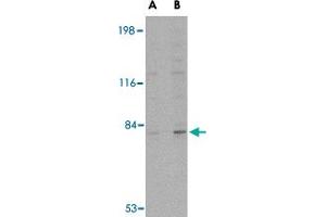 Western blot analysis of GPAM in rat brain tissue lysate with GPAM polyclonal antibody  at (A) 1 and (B) 2 ug/mL . (GPAM Antikörper)