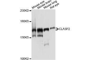 Western blot analysis of extracts of various cell lines, using CLASP2 antibody. (CLASP2 Antikörper)