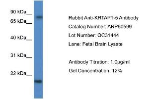 Western Blotting (WB) image for anti-Keratin Associated Protein 1-5 (KRTAP1-5) (C-Term) antibody (ABIN2788509)