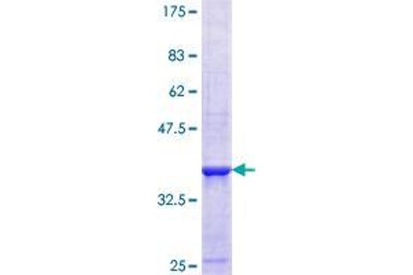 ETHE1 Protein (AA 155-254) (GST tag)