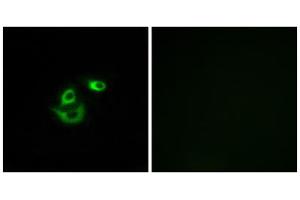 Immunofluorescence analysis of A549 cells, using CLCC1 antibody. (CLCC1 Antikörper  (Internal Region))