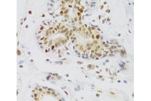 Immunohistochemistry of paraffin-embedded Human breast using NASP Polyclonal Antibody at dilution of 1:100 (40x lens). (NASP Antikörper)