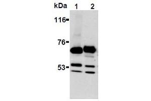 Western Blotting (WB) image for anti-Synaptotagmin I (SYT1) antibody (ABIN1109184) (SYT1 Antikörper)