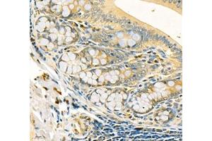 Immunohistochemistry (Paraffin-embedded Sections) (IHC (p)) image for anti-Cadherin 19 (CDH19) antibody (ABIN7073258)