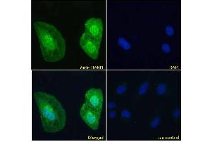 ABIN6391387 Immunofluorescence analysis of paraformaldehyde fixed U2OS cells, permeabilized with 0. (TIAM1 Antikörper  (C-Term))