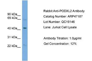 WB Suggested Anti-PODXL2  Antibody Titration: 0. (PODXL2 Antikörper  (N-Term))