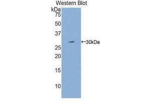 Western Blotting (WB) image for anti-Interleukin 2 Receptor, gamma (IL2RG) (AA 23-262) antibody (ABIN1174734)