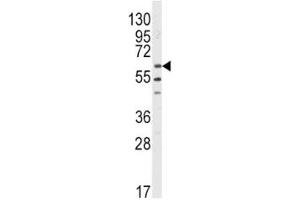 Western Blotting (WB) image for anti-V-Yes-1 Yamaguchi Sarcoma Viral Related Oncogene Homolog (LYN) (AA 32-62) antibody (ABIN3029564)