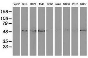Image no. 1 for anti-Sequestosome 1 (SQSTM1) antibody (ABIN1499990)