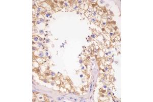 (ABIN6242519 and ABIN6577251) staining PDXK in human testis tissue sections by Immunohistochemistry (IHC-P - paraformaldehyde-fixed, paraffin-embedded sections). (PDXK Antikörper  (AA 1-312))