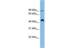 Image no. 1 for anti-NEDD4 Binding Protein 2-Like 2 (N4BP2L2) (AA 107-156) antibody (ABIN6745094) (N4BP2L2 Antikörper  (AA 107-156))