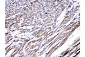 Immunohistochemistry (IHC) image for anti-Cholinergic Receptor, Nicotinic, alpha 5 (Neuronal) (CHRNA5) (AA 44-76) antibody (ABIN5647951)