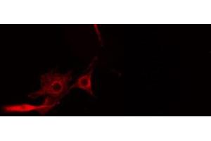 ABIN6274566 staining HeLa cells by IF/ICC. (14-3-3 theta Antikörper  (Internal Region))