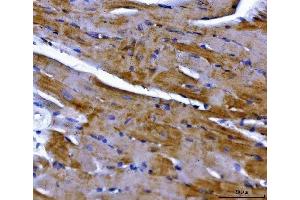 IHC analysis of NDUFS2 using anti-NDUFS2 antibody (ABIN7599417).