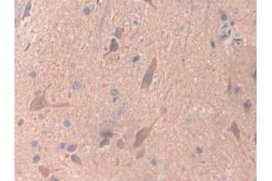 Immunohistochemistry (IHC) image for anti-Ubiquitin D (UBD) (AA 1-155) antibody (ABIN7442102)