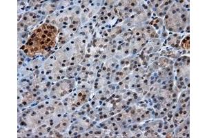 Immunohistochemical staining of paraffin-embedded Kidney tissue using anti-GBE1 mouse monoclonal antibody. (GBE1 Antikörper)