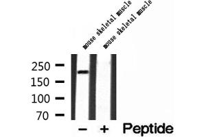 Western blot analysis of extracts of mouse skeletal muscle tissue, using MYH4-Specific antibody. (MYH4 Antikörper  (Internal Region))