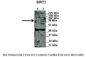 Lanes:   1. (SIRT1 Antikörper  (N-Term))