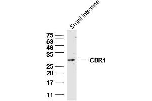 Mouse small intestine lysate (40ug) probed with CBR1 Polyclonal Antibody, unconjugated  at 1:300 overnight at 4°C followed by a conjugated secondary antibody for 60 minutes at 37°C. (CBR1 Antikörper  (AA 201-277))