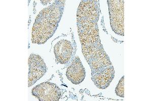IHC analysis of PDCD6IP using anti-PDCD6IP antibody (ABIN7600490). (ALIX Antikörper  (AA 2-330))