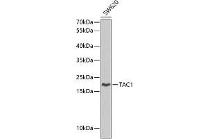 Western blot analysis of extracts of SW620 cells, using T antibody (ABIN3022354, ABIN3022355, ABIN3022356 and ABIN6218756) at 1:1000 dilution. (TAC1 Antikörper  (AA 1-129))