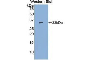 Western blot analysis of the recombinant protein. (ADCY9 Antikörper  (AA 1029-1282))