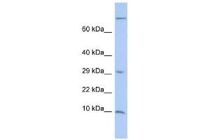 Western Blotting (WB) image for anti-Matrix Gla Protein (MGP) antibody (ABIN2459483)
