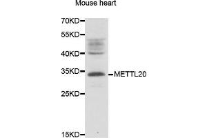 Western blot analysis of extracts of Mouse heart lysate, using METTL20 antibody. (METTL20 Antikörper)