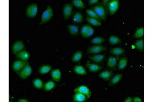 Immunofluorescent analysis of A549 cells using ABIN7145071 at dilution of 1:100 and Alexa Fluor 488-congugated AffiniPure Goat Anti-Rabbit IgG(H+L) (COQ8B Antikörper  (AA 10-137))