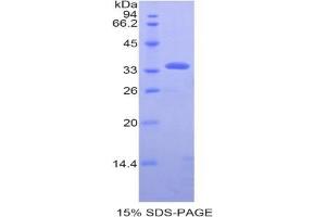 SDS-PAGE analysis of Human PDHb Protein. (PDHB Protein)
