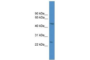 WB Suggested Anti-DRAM Antibody Titration: 0. (DRAM Antikörper  (N-Term))
