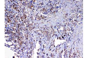 Immunohistochemistry (IHC) image for anti-Mitochondrial Antiviral Signaling Protein (MAVS) (AA 34-96) antibody (ABIN5518935)