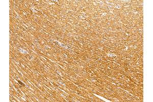 ABIN7094599 and ABIN7098649 at 1/100 staining Rat heart tissue by IHC-P. (PRTN3 Antikörper  (Internal Region))