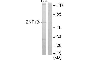 Western blot analysis of extracts from HeLa cells, using ZNF18 antibody. (ZNF18 Antikörper  (Internal Region))