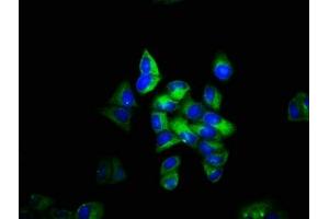 Immunofluorescence staining of Hela cells with ABIN7171484 at 1:133, counter-stained with DAPI. (TLN1 Antikörper  (AA 92-399))